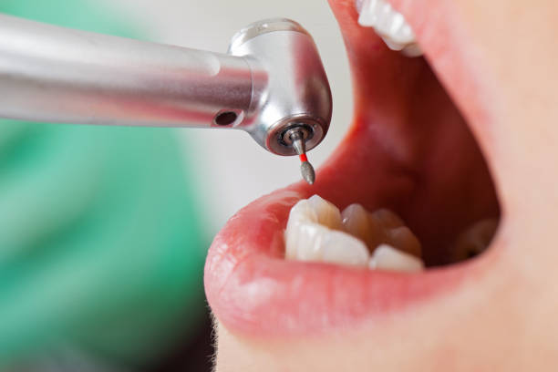 Best Walk-In Emergency Dentist in Francisville, KY